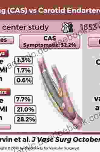 Carotid Interventions Kenneth J Doka