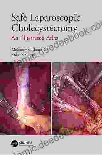 Safe Laparoscopic Cholecystectomy: An Illustrated Atlas